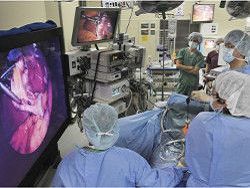 В Японии провели операцию, используя новейший эндоскоп